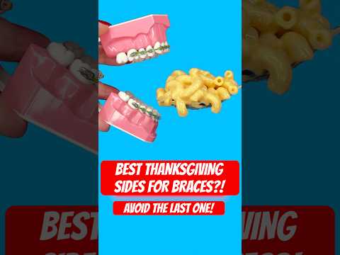 BEST THANKSGIVING SIDES FOR BRACES ?! *AVOID THE LAST ONE 🤯🦷 #braces #thanksgiving #asmrfood