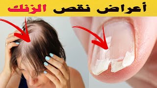 هل تعاني من هذه الأعراض؟ قد تكون تعاني من نقص الزنك دون أن تدري!