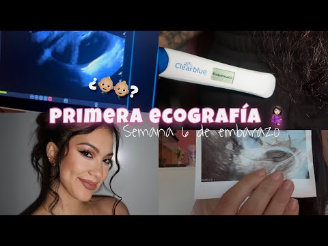 Primera ecografía 🤰🏻!! Son dos bebés? 👶🏼👶🏼|| Vlog semana 6 de embarazo