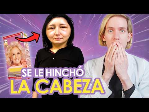 SE TIÑÓ EL PELO y CASI SE DESVIVE  - Se le AGRANDÓ LA CABEZA -  ¿Teñirse es peligroso?
