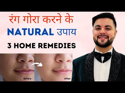 रंग गोरा करने के Natural उपाय: 3 Home Remedies for Skin Whitening & Brightening