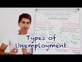Unemployment Types and Causes