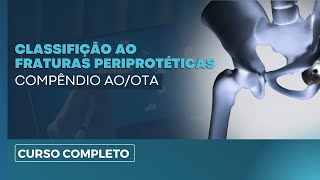 Classificação AO das Fraturas Periprotéticas: Entenda de Forma Simples