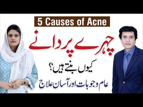 How to Cure Acne/Pimples Naturally at Home | Dr. Ali Kazmi | Dermatologist