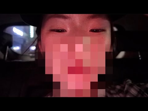 한국 온김에 성형외과 간 유학생 브이로그