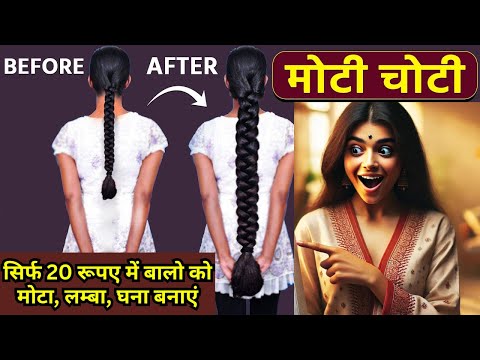 रूखे सूखे बेजान बालों में भी डाल देगा एक नई जान - 100% नए बाल उगाएँ |  DIY Powerful Hair Growth