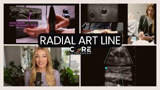 POCUS-Guided Arterial Lines