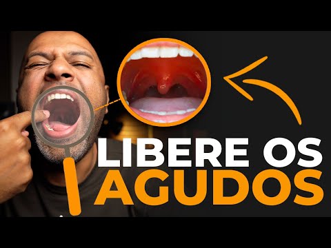 Soltar a Voz nos AGUDOS com potência e tirando a voz da garganta (Palato Mole)