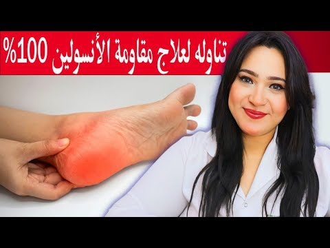 تناولة لعلاج مقاومة الأنسولين 100% والتخلص من السكرى والجلطات .. علامات مقاومة الأنسولين المبكرة