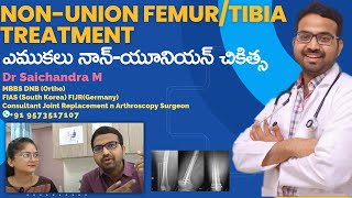 Non-Union Femur/Tibia Treatment | ఎముకలు నాన్-యూనియన్ చికిత్స | Dr. Sai Chandra MBBS DNB Ortho