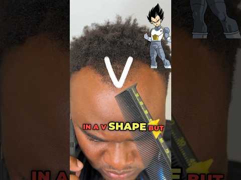 $100 V Hairline Pushback ‼️ 😱💈#hairline #hairlinerestoration