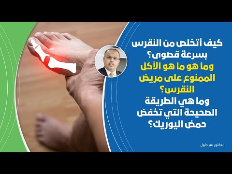 الان ... علاج النقرس النهائي خلال مدة قصيرة  ما لا تعرفه عن اليورك اسيد وكيف تحمي نفسك من أفظع ألم