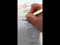 Eye Conditions and Their Characteristics