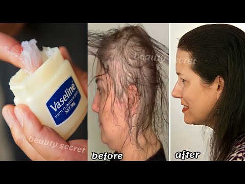 How to use Vaseline for double hair growth, your hair will grow 3 times faster.