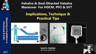 Valsalva & Goal-Directed Valsalva Maneuver  For HOCM, PFO & SVT