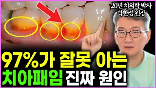 "양치질이 문제가 아닙니다" 잇몸 내려간 치아패임 진짜 원인과 증상에 따른 해결법 (박한성 원장 2부)