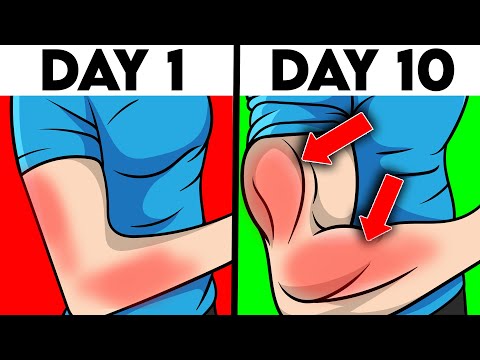 5 min a day to improve your ARM SIZE (Triceps + Forearm)