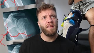 Die schlimmsten 3 Jahre meines Lebens (Kreuzbandriss, Depressionen, Schulterbruch)