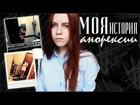 МОЯ ИСТОРИЯ АНОРЕКСИИ // ._.
