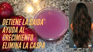 AGUA DE CEBOLLA PARA EL CRECIMIENTO DEL CABELLO