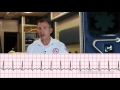 Tachycardia and Heart Rate Concepts