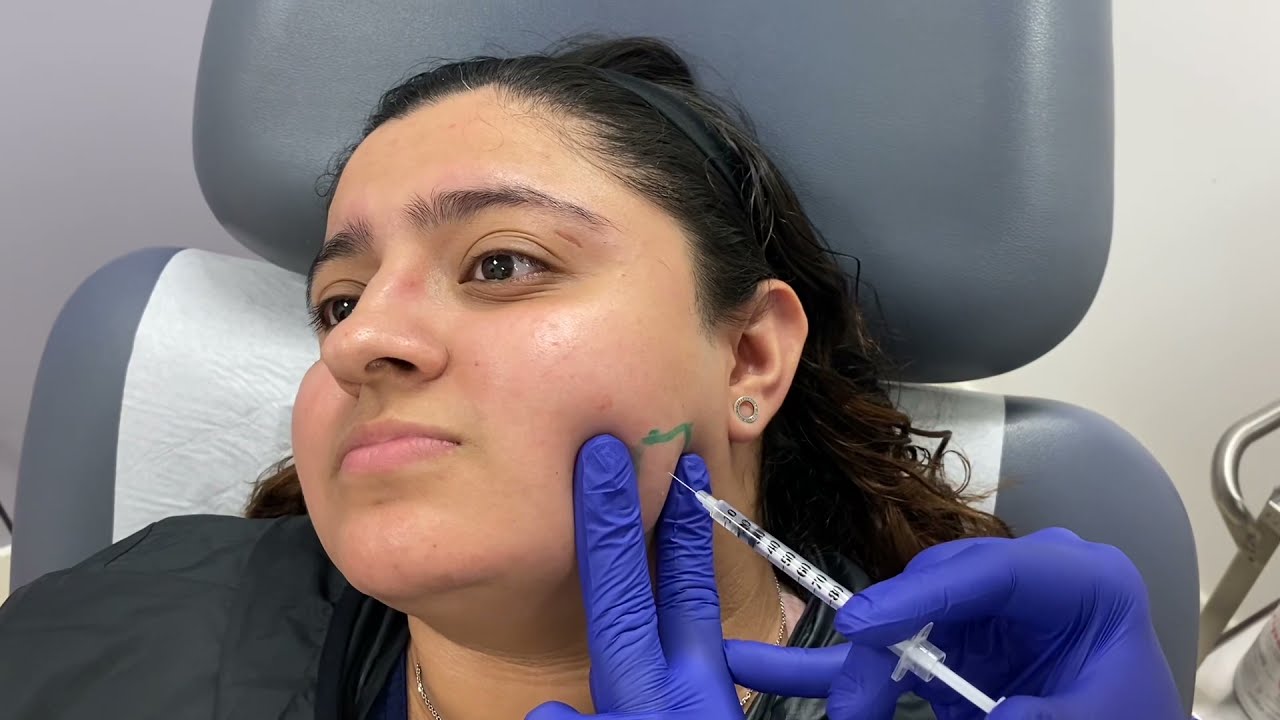 Woman with markings for cosmetic procedure preparation.