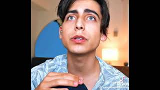 Aidan sin sus lunares 😱