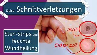 Das Katzenverbandpflaster | Steri-Strips und kleinere Schnittwunden | Erste Hilfe Tutorial