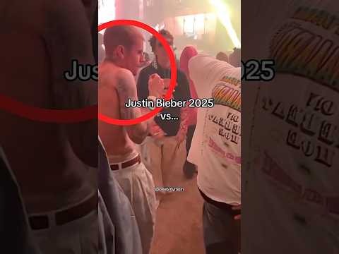 What Happened to Justin Bieber? 😔💔 #justinbieber #shorts #youtubeshorts #trending #viral