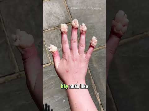 Ngón Tay Nhăn Sau Khi Ngâm Nước: Vì Sao?