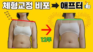 비포애프터 확 달라진 골반, 체형교정 후기 You could be next !
