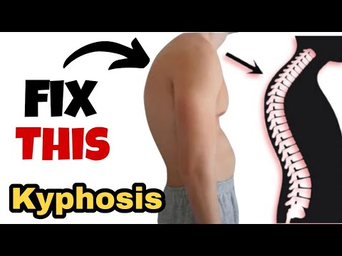 kyphosis correction exercises at home.How to correct upper body posture.पीठ के कूबड़ को कैसे ठीक करे