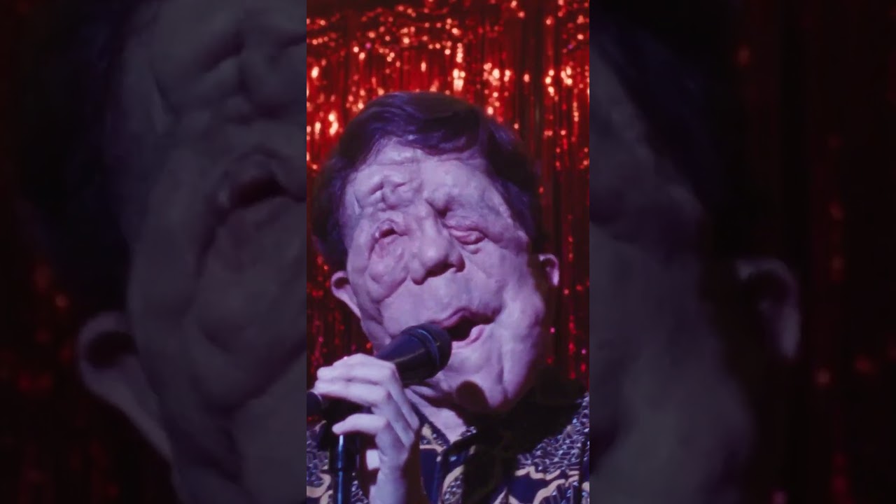 A Different Man anteprima del trailer