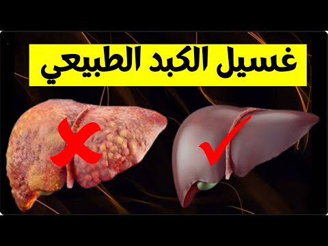 اغسل كبدك كل يوم بهذه الحيل البسيطة  - 8 علامات غريبة تشير إلى انك تعاني من تلف الكبد