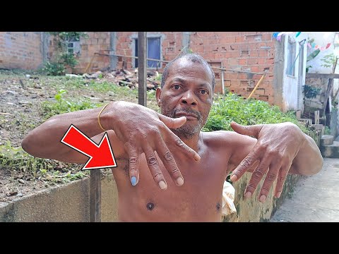 NAL  EXPLICOU PORQUE PINTOU A UNHA MAS NÃO CONVENCEU