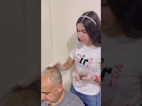 Adiós a la Calvicie 🇻🇪 Janin Al Chair