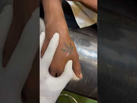 Selvatattoo#7305350319 #tattoo #subscribe #tattooer #love #remover #tattooremoval