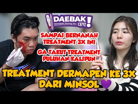 SAMPAI BERNANAH TREATMENT KE 3X MINSOL😱😱😱