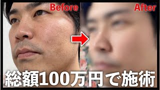 美容整形クリニックへ男友達を連れて行ったら泣いてしまった…