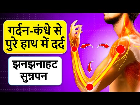 गर्दन की दबी नस का इलाज|Cervical Rediculopathy Exercises|Neck Pain Relief Exercises