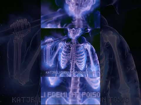 AUTOPSY — Kartman, Najm 🩻