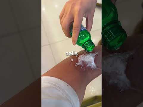Why hydrogen peroxide is bad for wounds?๐ค
