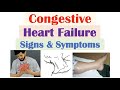 Heart Failure Symptoms and Conditions