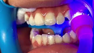 Come see the dentist and show them braces