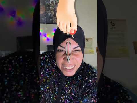 هوب بينا فلتر انزع الشوكة 😂 #اكسبلور #فولو #تيك_توك #ترند
