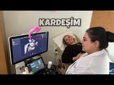 KARDEŞİMİN KONTROLÜNE GİTTİM !! NET YÜZÜNÜ GÖRDÜM