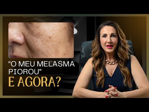 O MEU MELASMA PIOROU! E AGORA?