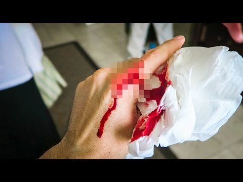 ACCIDENT IN PARADISE (WARNING GRAPHIC)