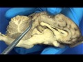 Cerebral Structures and Functions