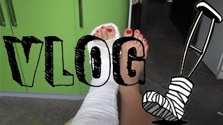 VLOG: нога под слоем гипса  leg  cast sexy red nails